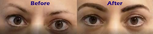 (Medium Brown) - Finally Hair Dab-on Hair Loss Concealer, Hairline Creator, Eye Brow Enhancer, and Beard Filler. for Thicker Hair use it First Then Apply Our Hair Fibres. (Medium Brown)