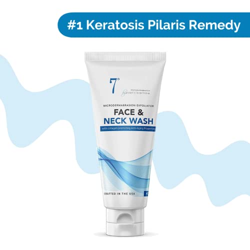 Microdermabrasion Keratosis Pilaris & Acne Exfoliating Deep Cleansing Face & Body Scrub, KP Bump Eraser, Back Acne Exfoliant, Wash Cleanser - Rough, Bumpy & Dry Skin Gets Rid Of Redness