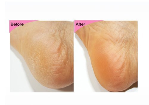 Esfolio Foot & Heel Peeling Mask, 1 Ounce