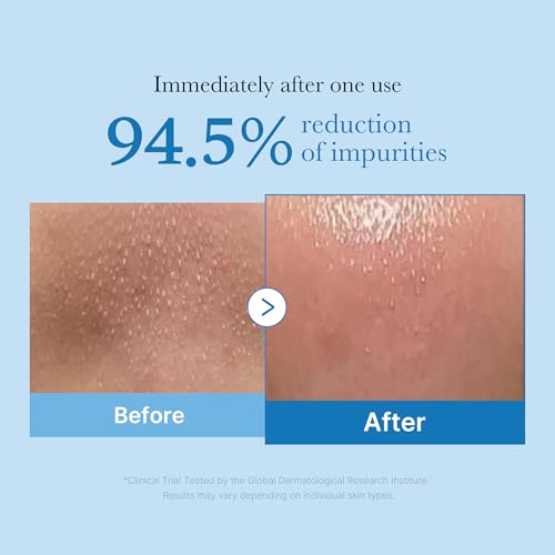 medicube Jelly & Oil Cleanser Duo: PDRN Jelly to Foam and Zero Pore Blackhead Cleansing Oil for Makeup Removal & Pore Care | Hydrating, Low-Irritation Daily Cleanse | Korean Skincare