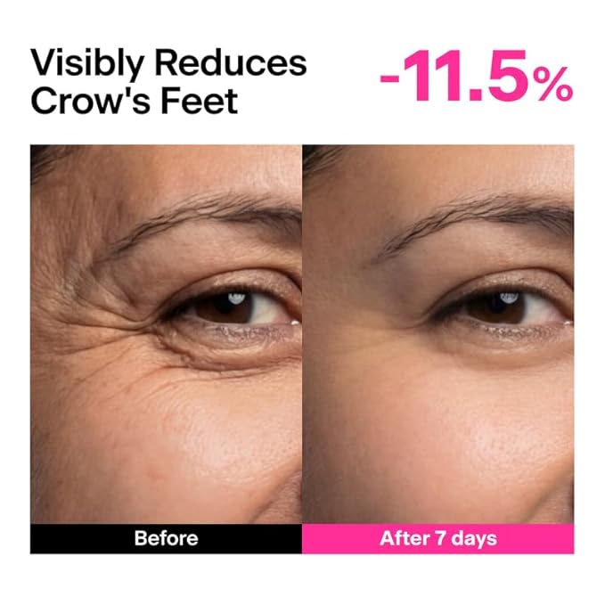 THOME CPR Serum - Collagen 1% + Peptide 1% + Retinal 0.1% Triple Synergy Mechanism, High Potency Firming Serum for Fine Lines & Wrinkles, Texture & Pore Refining, Korean Skincare, 1.01 fl oz.