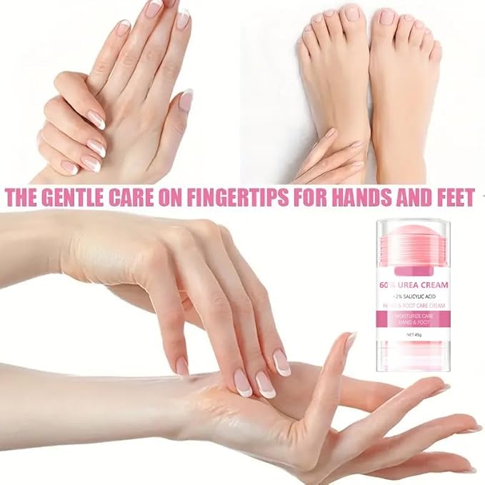 Grospe 60% Urea plus 2% Salicylic Acid Hand and Foot Cream, Peach Scented Hand and Foot Moisturizer for Rough and Dry Cracked Hands, Elbows, Feet and Heels, Exfoliating Repair Balm, 1.58 OZ