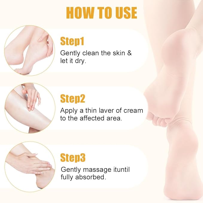 60% Urea Cream plus 2% Salicylic Acid Foot Cream for Removing Calloused Skin, Cracked Hands Elbows Feet Heels Moisturizes and Hydrates, Maximum Strength Skin Barrier Repair Hand Cream (Urea, 1.41 oz)