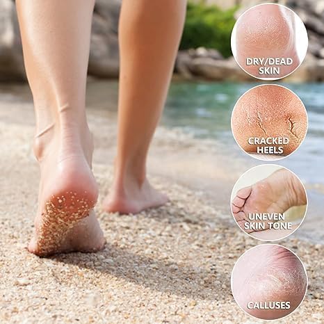 Goat Milk Foot Peel Mask (6 Pack), Exfoliating Foot Mask for Dry Cracked Feet, Dead Skin Callus Remover, Foot Exfoliator for Baby Soft Feet (Goat Milk)