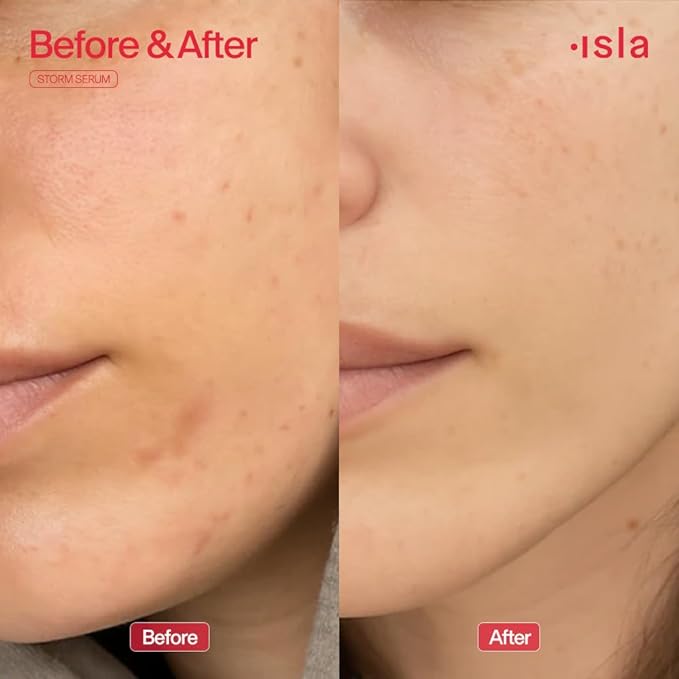 ISLA Storm Serum Firming Hydration Treatment, Improves Skin Firmness, Reduces Visible Fine Lines & Calms Redness, Chronopower, Glycation Complex & Phytocelltec, Made in Switzerland, 1.01 fl oz