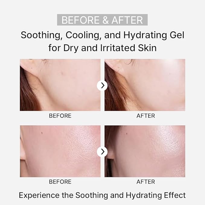 ARZTIN Rejuvenation Pflege Gel, Moisturizing Smoothing Cooling Gel Essence, Soothing Refreshing Non-Sticky Gel, Soothing and Hydrating Aloe Vera for Dry & Sensitive Skin