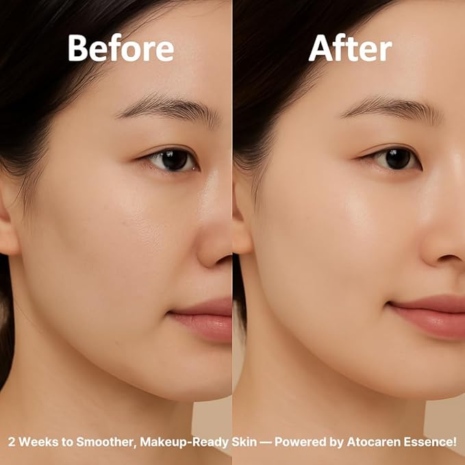 Calendula Essence – Popular Korean Soothing Serum with 200,000ppm Calendula, Fragrance-Free, Hydration & Anti-Aging Care for Sensitive Skin