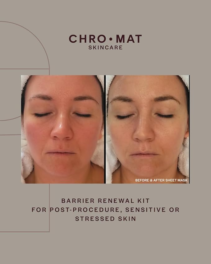 CHROMAT Barrier Renewal Kit – Skin Barrier Repair Routine for Sensitive & Redness-Prone Skin, Peptide Serum, Hydrating Face Moisturizer Cream, Gentle Cleanser & Recovery Mask