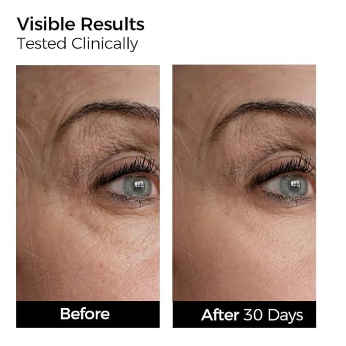 WNP collagen Serum Anti Aging,Oil-Suspension Serum|Barrier repair Firming Emergency Repair|WaterOilBalance| 4D hyaluronic acid|Single-Use Vials Skincare for Sensitiveskin 10pcs