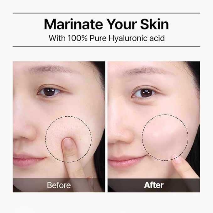 WELLAGE Real Hyaluronic Blue Ampoule 100, Korean Hydrating Serum for Face, Fragrance Free Hyaluronic Acid Deep Moisturizing Serum with Panthenol, PDRN for Sensitive Dry Skin Moisturizer, 2.54 Fl Oz_R