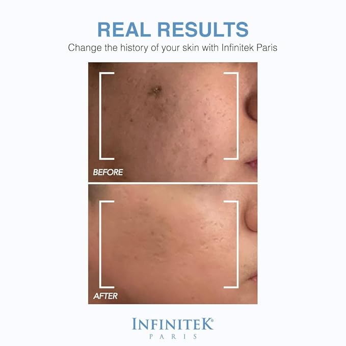Infinitek Paris Hyaluronic Acid Serum with Organic Silicon | Deep Hydration & Firming Face Serum for Anti-Aging, Smoothing Fine Lines & Wrinkles | Facial Skincare | 1 fl oz / 30 ml