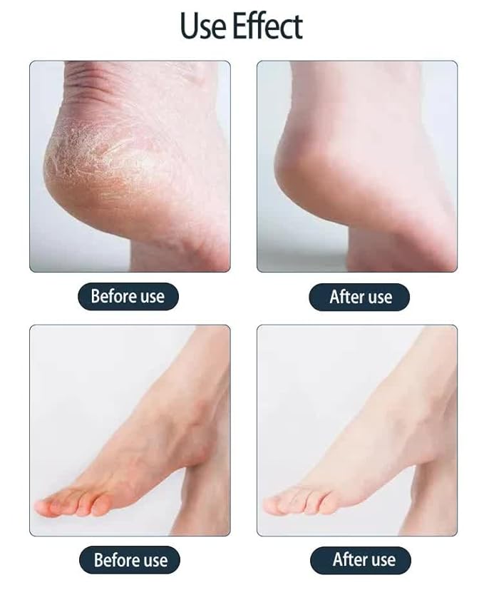 Moisturizing Foot Mask, white