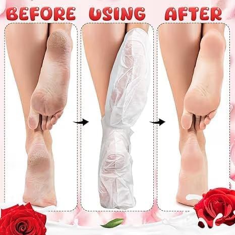 Damask Rose Foot Peel Mask (6 Pack), Exfoliating Foot Mask for Dry Cracked Feet, Dead Skin Callus Remover, Foot Exfoliator for Baby Soft Feet (Rose)
