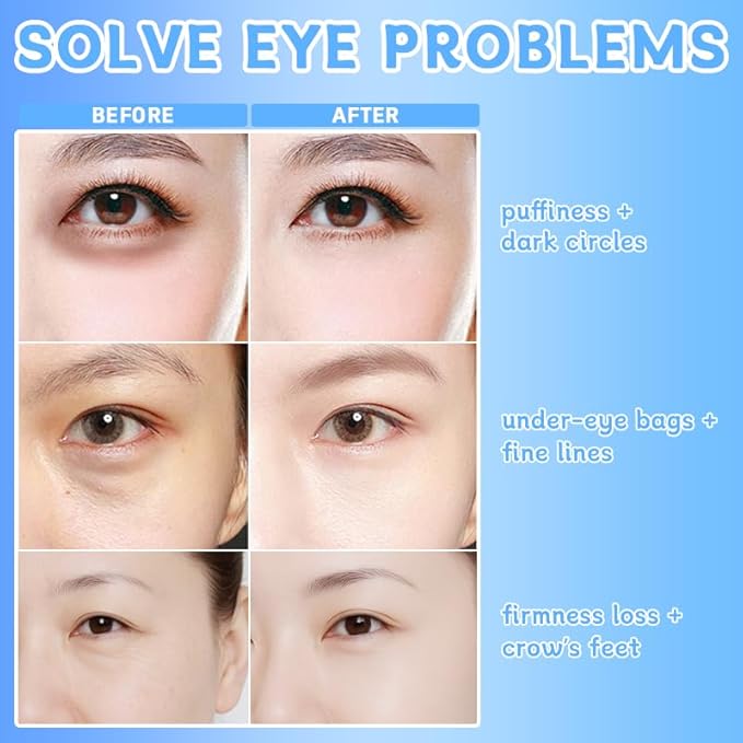 Instant Firming Eye Serum,Visibly Reduces Under-Eye Bags, Wrinkles, Dark Circles, Fine Lines & Crow's Feet Instantly,Anti-Aging Formula for Under Bags and Wrinkles,10ml（2PCS）
