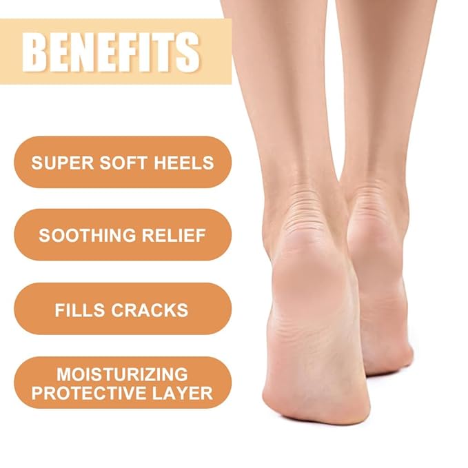 60% Urea Cream - Foot Hand Cream Stick for Dry & Cracked Feet Elbows Knees Heels Hands, Hydrates & Nourish Foot Care for Softening and Moisturizing, Removing Calloused Skin (Manuka Honey, 1.41 oz)
