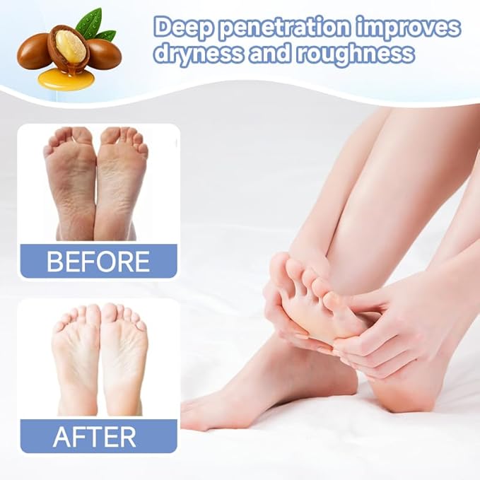 4Pairs PDRN & Collagen & Niacinamide Foot Mask | Foot Peeling and Dead Skin Removal*, Relief Dry and Cracked Feet Skin | Urea, Shea butter, Coconut oil, Salicylic Acid, Hyaluronic | Korean Feet Care