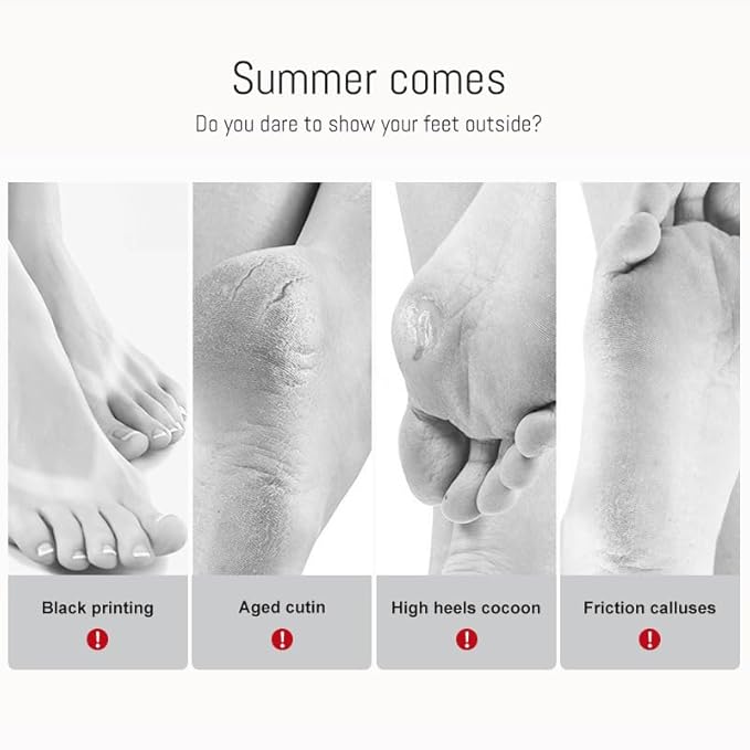 5 Pairs Foot Peel Mask, Exfoliating Foot Peeling Mask for Dead Skin, Callus Remover Foot Mask, Shea Butter & Avocado