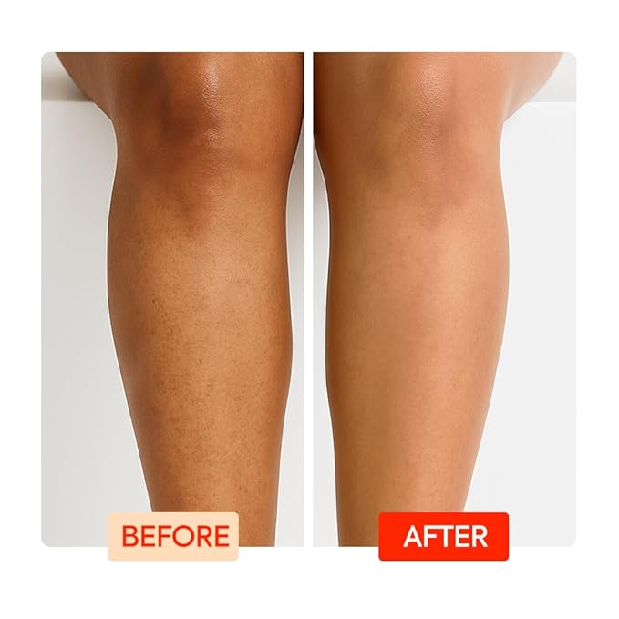 MAKARI IYKYK Vitamin C + Turmeric Body Toning Cream | Lightweight Firming Lotion for Women | Helps Improve the Look of Dark Spots | Vegan, Fragrance-Free