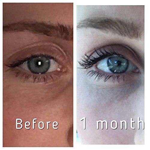 Pronexa Hairgenics Lavish Lash – Eyelash Growth Enhancer & Brow Serum with Biotin & Natural Growth Peptides for Long, Thick Lashes and Eyebrows! Dermatologist Certified, Cruelty Free & Hypoallergenic.
