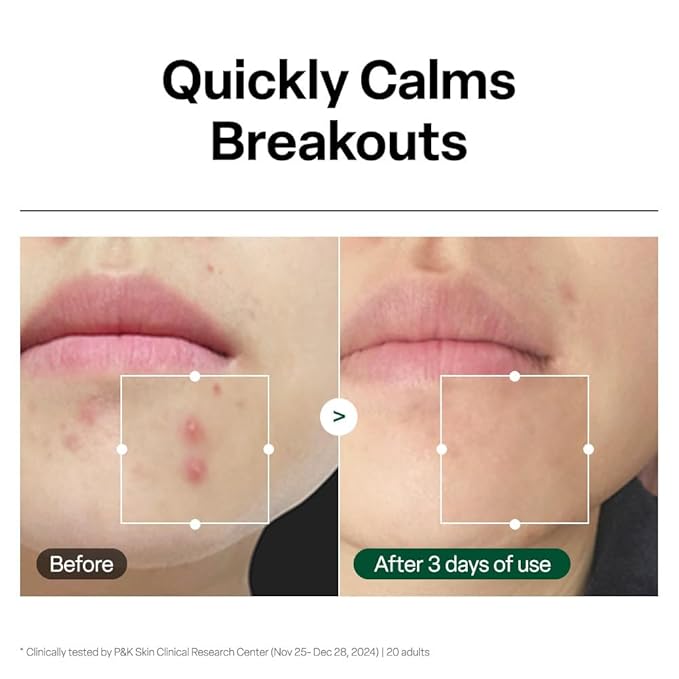 Dr. G R.E.D. Blemish Clear Hyal-Cica Soothing Serum - Korean Skincare - Long-Lasting, Hydrating Serum for All Skin Types - Cools Skin Temperature - Hyaluronic Acid & Centella Asiatica - 1.69 fl oz