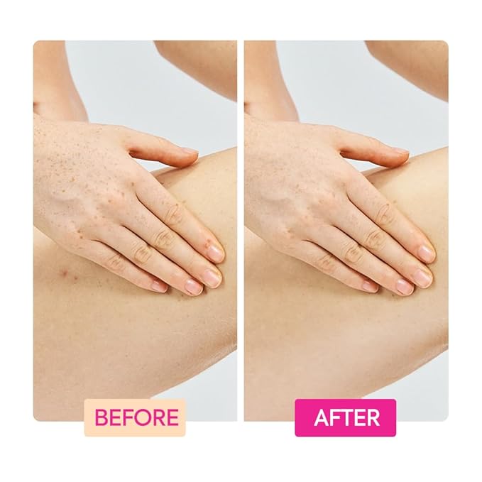 MAKARI IYKYK Ginger Extract, Tranexamic Acid & Retinol Body Toning Cream | Firming Body Lotion for Women | Helps Improve the Look of Elasticity & Smoothness | No Fragrance | Paraben & Sulfate-Free