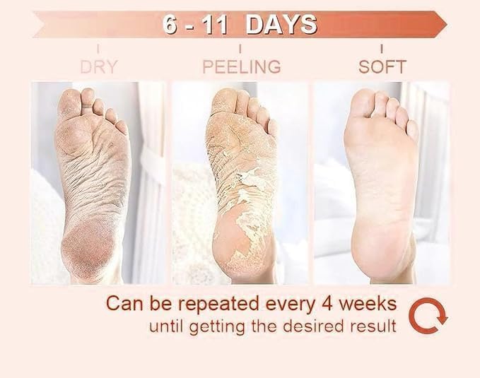 Goat Milk Foot Peel Mask (6 Pack), Exfoliating Foot Mask for Dry Cracked Feet, Dead Skin Callus Remover, Foot Exfoliator for Baby Soft Feet (Goat Milk)