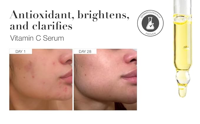 Infinitek Paris Vitamin C Facial Serum | With Organic Silicon & Ferulic Acid | Brightening Face Skincare Essential for a Smoother, Luminous Complexion | 1 fl oz / 30 ml