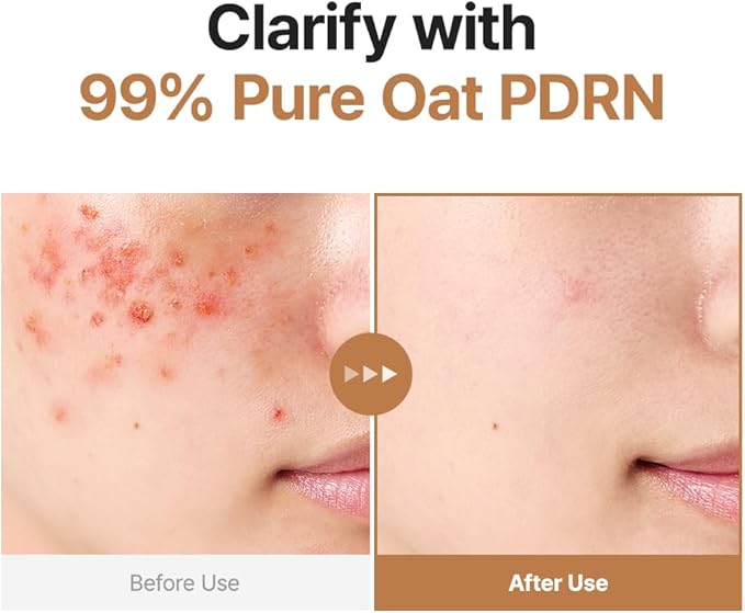 PURITO Oat PDRN Gentle Refining Toner 200 mL 6.76 fl.oz, Korean Oat Exfoliating Toner 99% Pure Oat PDRN, Hydrating & Clarifying Formula for Acne-Prone Skin, Vegan, Non-Comedogenic, Gentle Daily Use