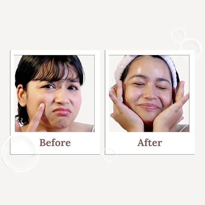 Suroskie Glow Grain Rice Enzyme Cleanser 50 Gm | Ceramide & Lactic | Deep Cleansing Foaming Facewash Powder For Hydrated, Glowing & Brighten Skin | Korean Skincare For All Skin Types For Men & Women