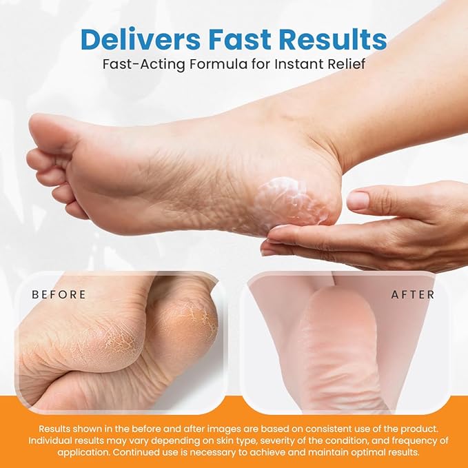 Revitaderm 4D 40% Urea Advanced Foot Cream for Cracked Heels & Dry Skin, Intensive Repair for Rough, Callused Feet, Fast Absorbing, Fragrance Free, Made in USA, 4 oz with Pumice & Brush, 3 Pack