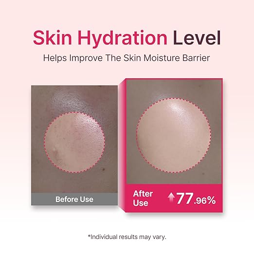 SECRETKEY Starting Rose Essence Toner, Galactomyces Ferment with Rose Water for Radiance Glass Skin, Hydrating Essence, Helps Improve Uneven Skin Tone, Korean Skin Care Essence (5.07 Fl Oz / 150ml)