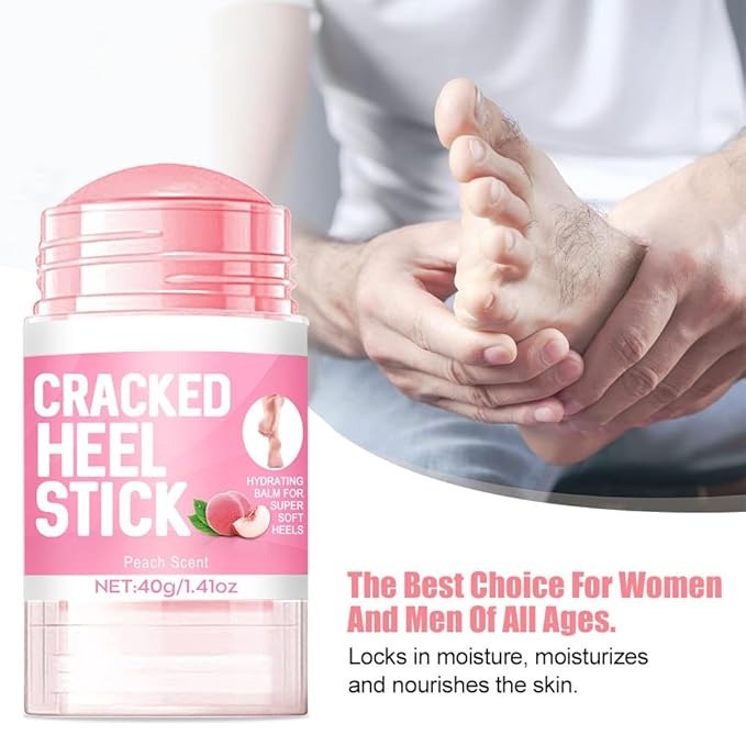 60% Urea Cream plus 2% Salicylic Acid - 1.41 oz Urea Foot Hand Cream Stick for Repairing Restore Balm, Cracked Hands Elbows Feet Knees, Moisturizes and Hydrates the Dry & Dead Skin (Peach, 1.41 oz)