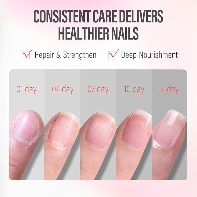 CHUCHU Vegan Cuticle Oil for Nails: Rose Jojoba Nail Cuticle Oil with Vitamin B & E for Moisturizes Cuticle and Nail's Skin - Prevents Hangnails and Chapped 15ML