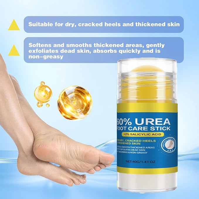 60% Urea with 2% Salicylic Acid Urea Foot Care Stick, Foot Cream Moisturizer for Dry Cracked Feet, Knees, Elbows, Hands,Moisturizes and Hydrates the Dry Skin,Callus Remover & Skin Softener 1.41oz