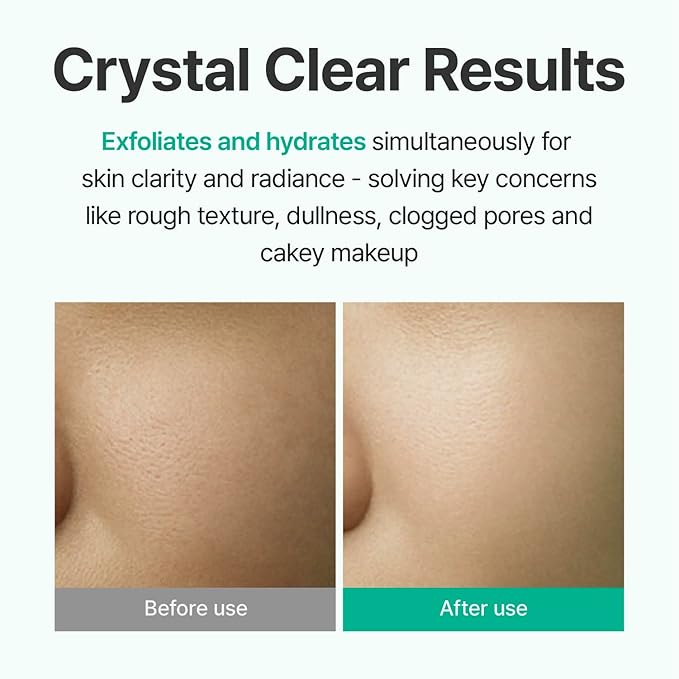 CENTELLIAN 24 AHA Aqua Peeling Boosting Ampoule (1.01fl oz) - Gentle Exfoliating & Hydrating Serum with AHA Complex, Refines Pores & Enhances Skin Clarity, Korean Skin Care