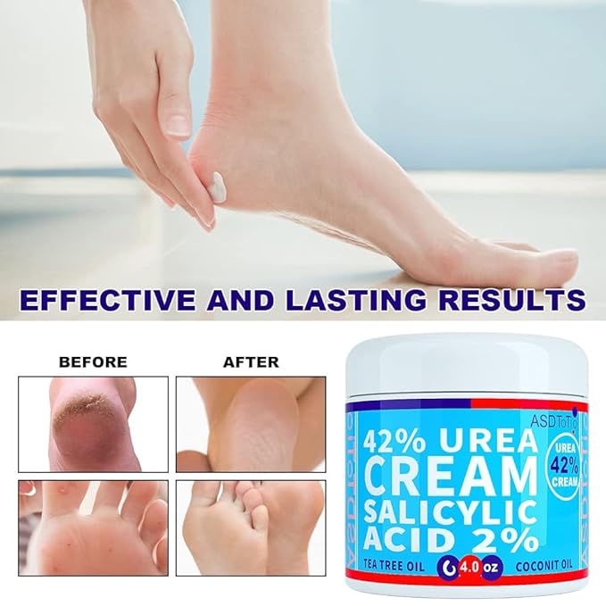 ASDToTio Urea Cream 42% - Premium Urea Foot Cream - With 2% Salicylic Acid, Tea Tree Oil, Shea Butter, Aloe Vera - For Feet, Hands, Heels, Elbows, Knees and More - 8 oz