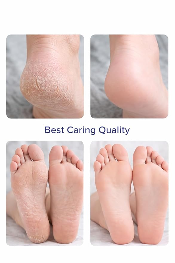 60% Urea Cream Stick with 2% Salicylic Acid, Maximum Strength Foot Cream for Dry Cracked Heels, Callus and Dead Skin Remover, Fast Absorbing, 1.4 oz, (1.41 oz pack of 2)