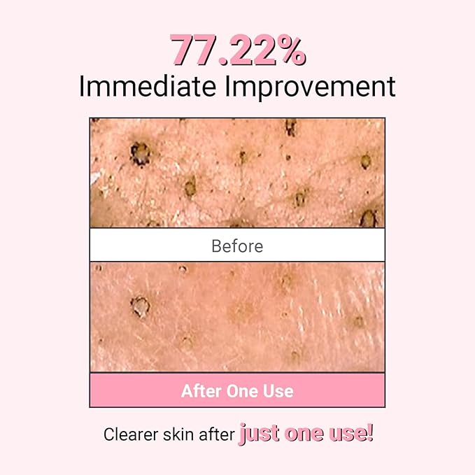 Kaolin Purifying Wash Off Pack, Pore Cleansing Mask for Dry Sensitive Skin, Softening and Hydrating, Korean Skincare (3.88oz / 110g)