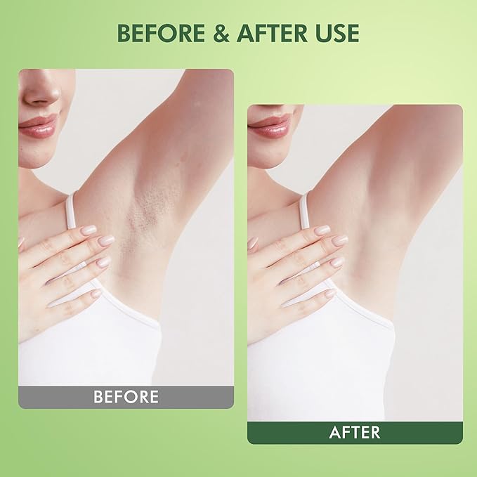 Armpit Detox and Scrub with Shea Butter and Coconut 8.82oz-Exfoliating Scrub with Natural Ingredients for Removing Odor, Deep Cleansing and Exfoliating, also for Legs, Knee, Feet, Hands and Body