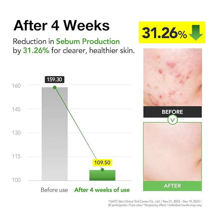 31% Reduction in Sebum & 15.5% High-Dose D-Panthenol | Calms Redness, Repairs Skin Barrier & Locks in Hydration | With Heartleaf Extract | Korean Skincare Daily Moisturizer (35 ml/1.18 fl.oz.)