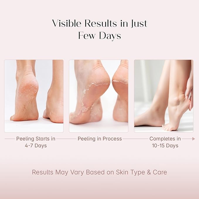 Seoul-Skin Glycolic Acid Foot Peeling Mask (1 Pair), Korean Peeling & Exfoliating | Deep Exfoliation