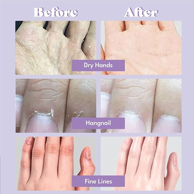 Catherine Muller Floral Hand Mask 8 Pairs, Moisturizing Gloves for Dry Hands withElder Flower & CICA, Repairing and Nourishing Hand Care Treatment for Cracked, Rough, and Dry Skin