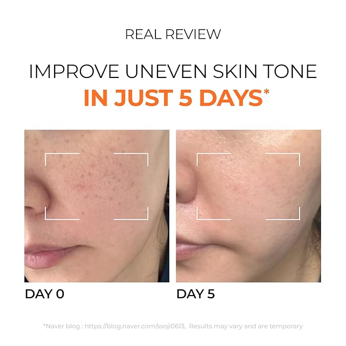 DOMINAS 10% Tranexamic Acid Serum (Hyper P-Toning) - Discoloration Correcting & Turnover Booster Brightening Serum with TXA, 5% AHA, 5% Niacinamide, Dark Spots, Pore Care, Korean Skincare, 1.01 fl oz