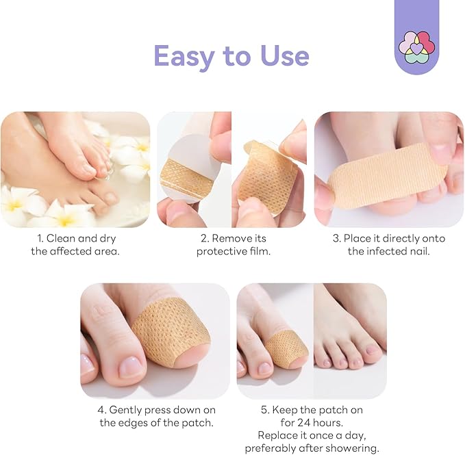 SAVILAND Extra Strength Fungal Nail Patches FSA-HSA: 64 Patch Overnight Repair 1% Tolnaftate Toenail Treatment Nighttime Nail Renewal Restores Damaged Nails Discolored Thick Yellow