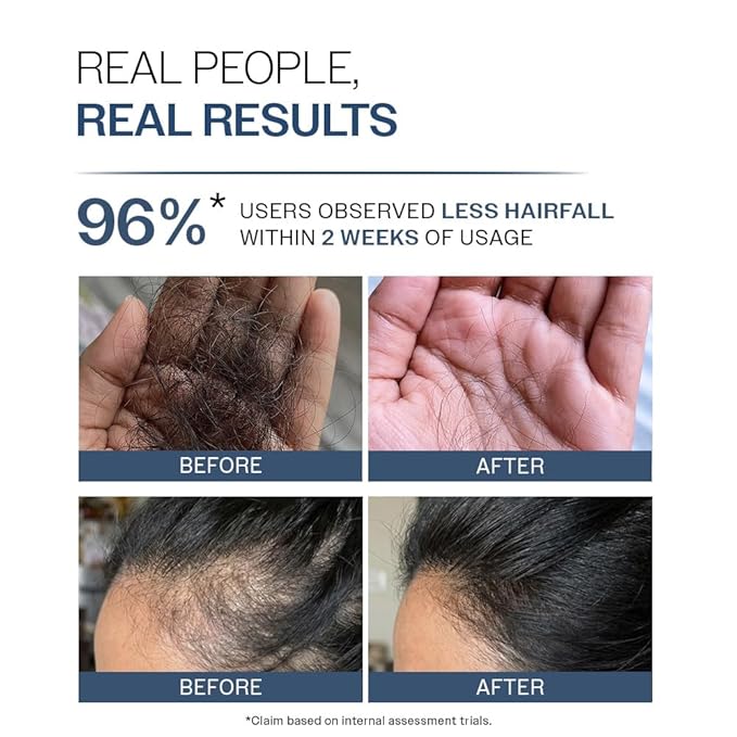 Bare Anatomy Anti-Hair Fall Shampoo | Provides 5x Hair Fall Control | pH 4.6 | Adenosine & Peptides | Strengthens Weak Roots & Reduces Breakage | Sulphate & Paraben Free | Unisex | 250ml