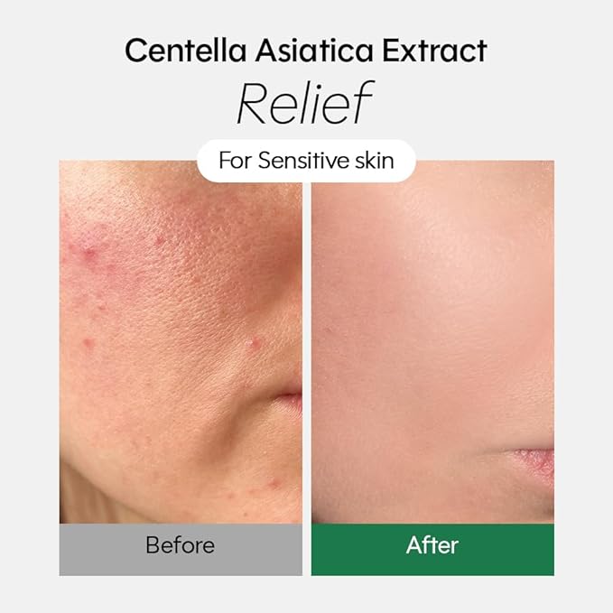 tenzero Relief Cica Hydrogel Eye Patch 60 Patches (90g), Centella Treatments for Puffy Eye, Fine Lines, Soothing, Eye Puffiness Reducer, Hydrating Eye Pads, Korean Under Eye Masks Skincare
