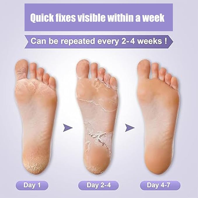 Foot Peel Mask 5 Pack, Exfoliator Peel Off Calluses Dead Skin Callus Remover, Baby Soft Smooth Touch Feet Spa Experience at Home & Gift Ideas - Lavender Scented