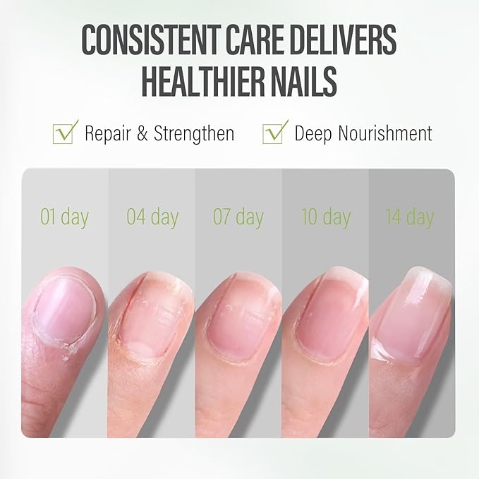 CHUCHU Vegan Cuticle Oil for Nail: Kiwi Scent Natural Vitamin B & E Nail Oil - Hydrates Moisturizes Repairs for Nails Damage Dry Cuticle 0.51 Fl Oz