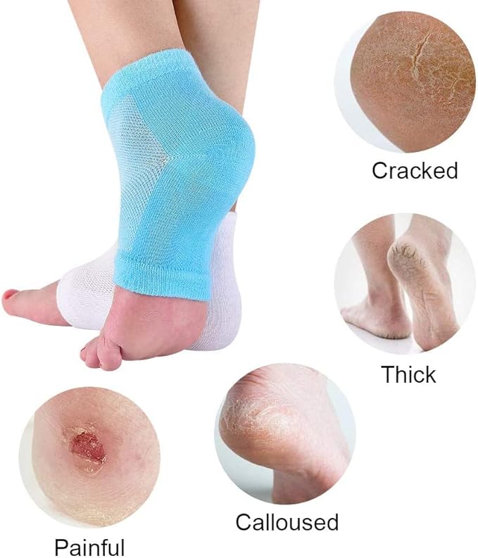 2 Pairs Moisturizing Gel Heel Socks Vented Unisex Day Night Toe Open Feet Care Dry Skin (2P_BlueWhite)