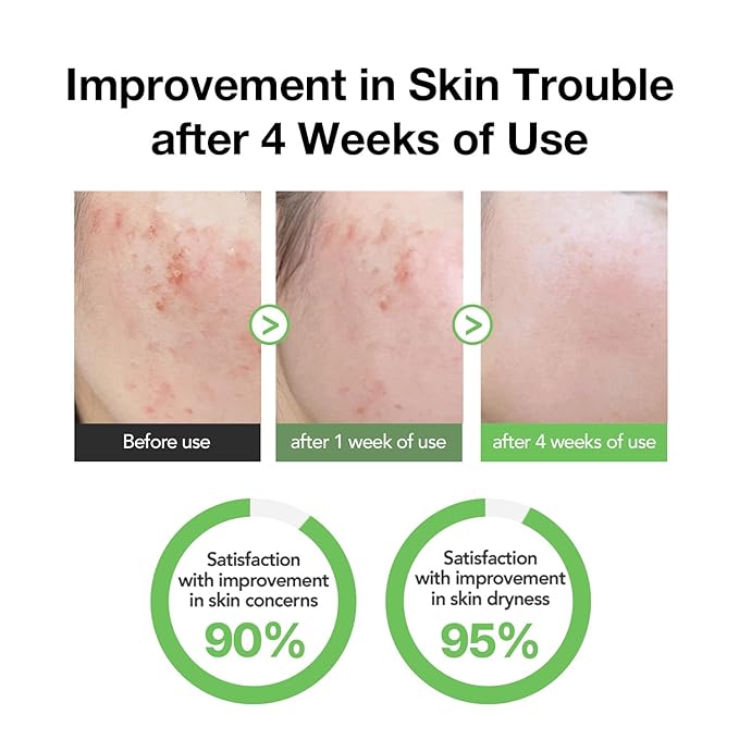 31% Reduction in Sebum & 15.5% High-Dose D-Panthenol | Calms Redness, Repairs Skin Barrier & Locks in Hydration | With Heartleaf Extract | Korean Skincare Daily Moisturizer (35 ml/1.18 fl.oz.)
